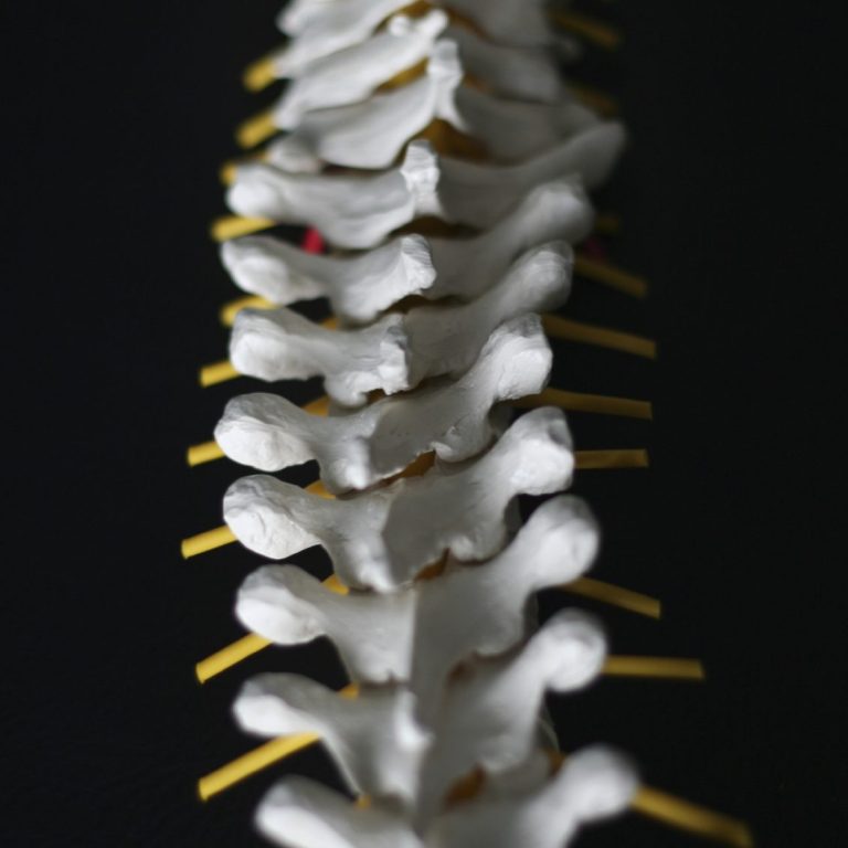 Abb WS-Syndrom